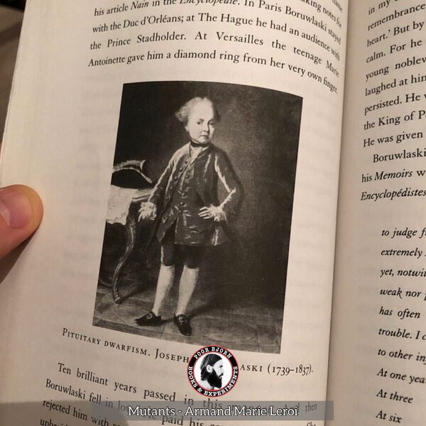Pituitary dwarfism - Joseph Boruwlaski, 1739-1837